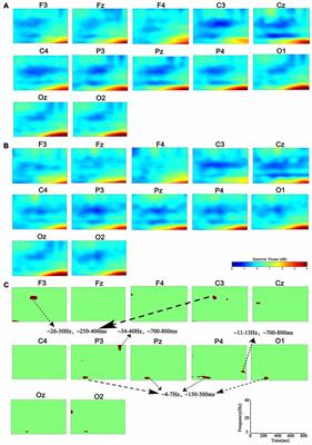 Localized Fluctuant Oscillatory Activity by Working Memory Load: A Simultaneous EEG-fMRI Study